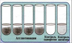 Reacții imunologice de detectare a antigenelor specifice - stadopedia