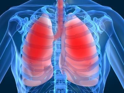 Cum să tratați inflamația pulmonară