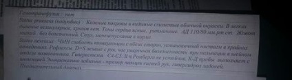 Hogyan kell kezelni az epilepszia-e, hogy a betegnek helyesen diagnosztizált „tüneti epilepszia”