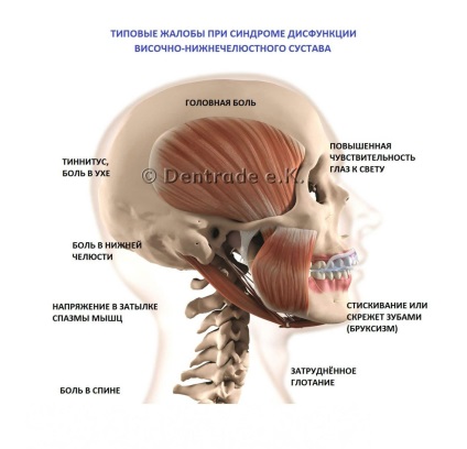 Kappa din bruxism - eficiență, preț, unde să cumpărați