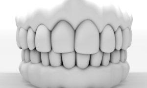 Carii dentare - cauze, simptome, prevenire și tratament - dinte medic