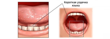 Corectarea chingelor - lumea stomatologiei