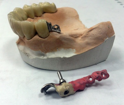 Magicsmile - laborator dentar