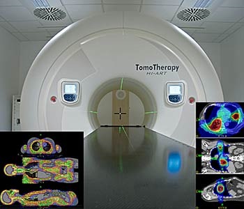 Mituri despre radioterapie, centrul ucrainean de tomoterapie