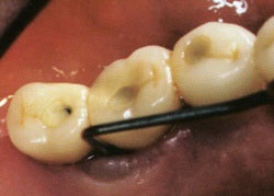Urmărirea unui medic după implantarea dentară