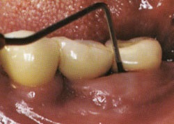Urmărirea unui medic după implantarea dentară