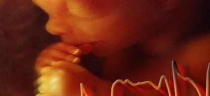 Az ultrahang nem látja a terhesség