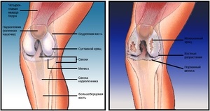 De ce durerile articulațiilor genunchiului, cauzele durerii severe, decât tratamentul genunchiului și ce trebuie să faceți
