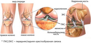 De ce durerile articulațiilor genunchiului, cauzele durerii severe, decât tratamentul genunchiului și ce trebuie să faceți