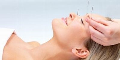 Beneficiile acupuncturii