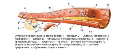 Medicamente și medicamente pentru curățarea vaselor de sânge și cum se curăță