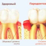 Rețete populare de propolis