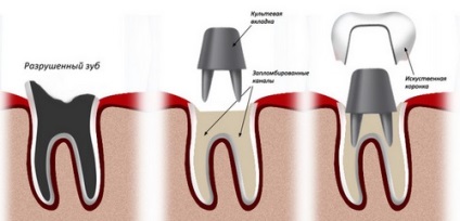 Tipuri și prețuri protetice de stomatologie, Stomatologie stomatologie, Sankt-Petersburg (spb)