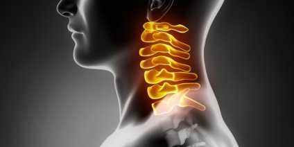 Proeminența discurilor coloanei vertebrale cervicale este cum este tratamentul