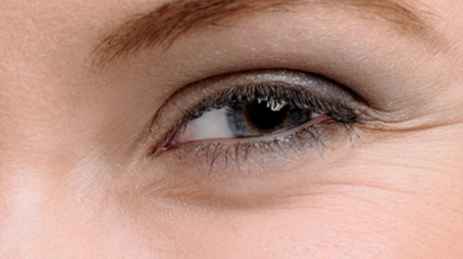Cele mai frecvente probleme cu ochii oamenilor