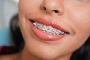 Argintarea dinților în efectul copiilor, recenzii, dinți din lapte