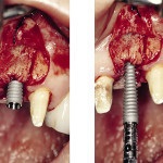 Revista dentară pentru reviste dentare 1