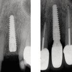 Revista dentară pentru reviste dentare 1