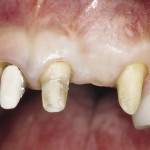 Revista dentară pentru reviste dentare 1