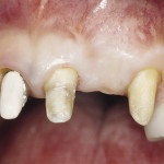 fogászati ​​magazin 1 Dental Journal