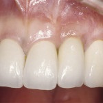fogászati ​​magazin 1 Dental Journal