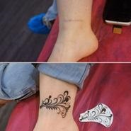 Tetoválás a hegek - Photo átfedő hegek tetoválás, tetoválás akadémia
