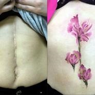 Tatuaj pe cicatrici - fotografie a unui tatuaj de cicatrici, academie de tatuaje