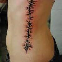 Scar Tattoo