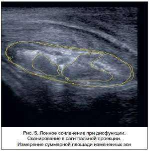 Diagnosticarea ultrasonică a stării articulației pubian la femei, logutova l