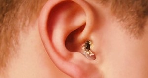 Lobul urechilor la om - cauze, tipuri, manifestări, tratament