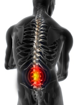 Extensia în hernia coloanei vertebrale cervicale și lombare