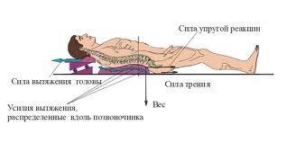 Extracția coloanei vertebrale cu o hernie
