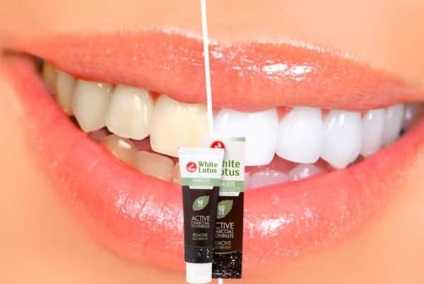 White lotus - pastă de dinți albă recenzie, recenzii, cumpărare, preț
