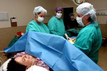 Sterilizarea feminină - sterilizarea tuburilor uterine