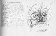 Neoplasme maligne ale maxilarelor, stomatologie terapeutică