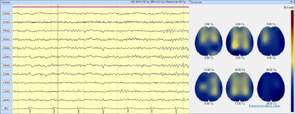 Terapia sonoră, 3 Hz, starea de veghe rugăciune, tratamentul de sunet, metoda de reabilitare, spiritualitatea