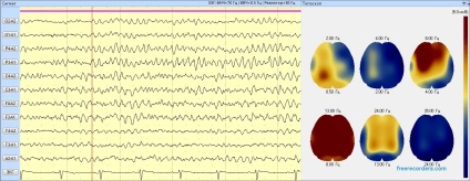 Terapia sonoră, 3 Hz, starea de veghe rugăciune, tratamentul de sunet, metoda de reabilitare, spiritualitatea