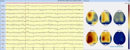 Terapia sonoră, 3 Hz, starea de veghe rugăciune, tratamentul de sunet, metoda de reabilitare, spiritualitatea