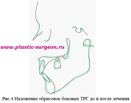 Andrishchev andrey Ruslanovich - posibilități moderne de corectare a zâmbetului gingival