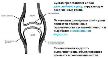 Osteoartrita - simptome, tratament, prognostic