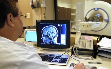 Astrocitomul creierului este ceea ce este, prognosticul de recuperare, simptomele și tratamentul