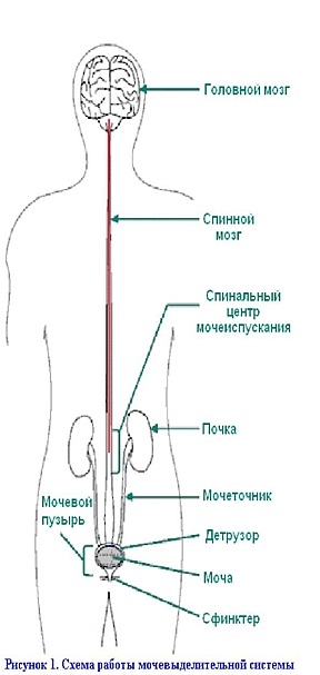 Bee-book - розсіяний склероз у фокусі