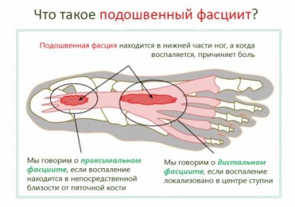 Ce doare alergătorii și când este timpul să alergi la doctor