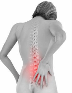Ce este radiculita coloanei vertebrale lombosacrale, tratament și exerciții
