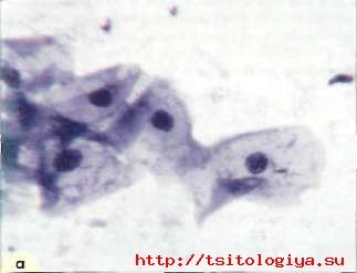 Caracteristici cytologice