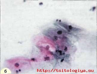 Caracteristici cytologice