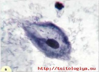 Caracteristici cytologice