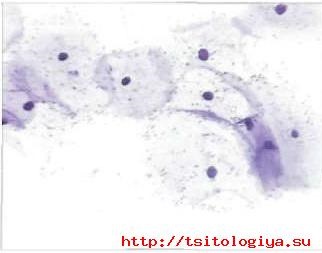 Caracteristici cytologice