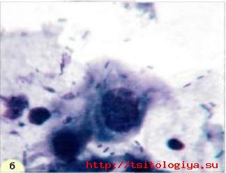 Caracteristici cytologice