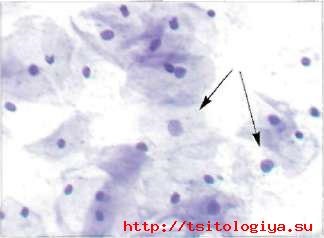 Caracteristici cytologice